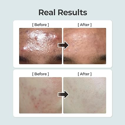 numbuzin No.1 Pure-Full Calming Herb Toner | Acne-Prone Skin, Centella Asiatica, Deep Calming (10.14 Fl Oz) - Image 3