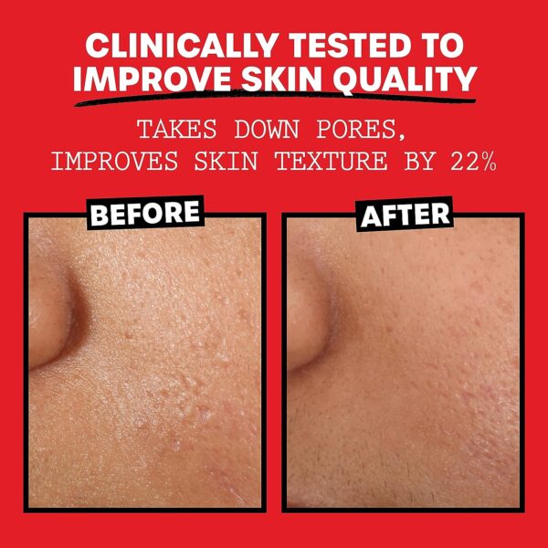 THAYERS AlcoholFree Witch Hazel Facial Toner with Aloe Vera Formula, Clear, Rose Petal, 3 Fl Oz - Image 9