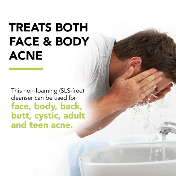 humane Maximum-Strength Acne Wash - 10% Benzoyl Peroxide Acne Treatment for Face, Skin, Butt, - Image 3