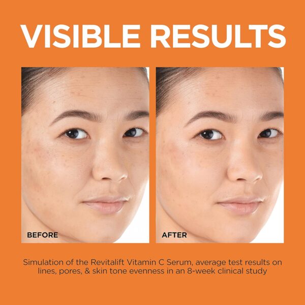 L'Oreal Paris Revitalift 12% Pure Vitamin C Serum, Vitamin E, Salicylic Acid, Brightening 1 oz + Moisturizer Sample - Image 5